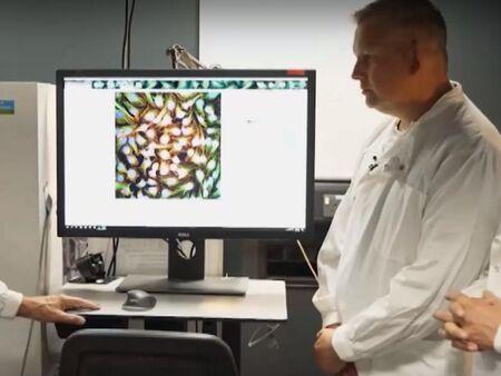 Разработват ваксина срещу рак на белия дроб на Острова 1 image